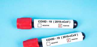 Muestras de Covid-19. coronavirus
